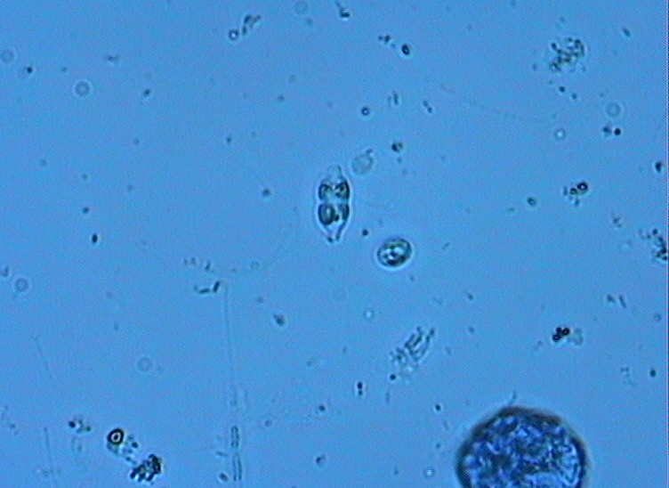 Dictyocha speculum